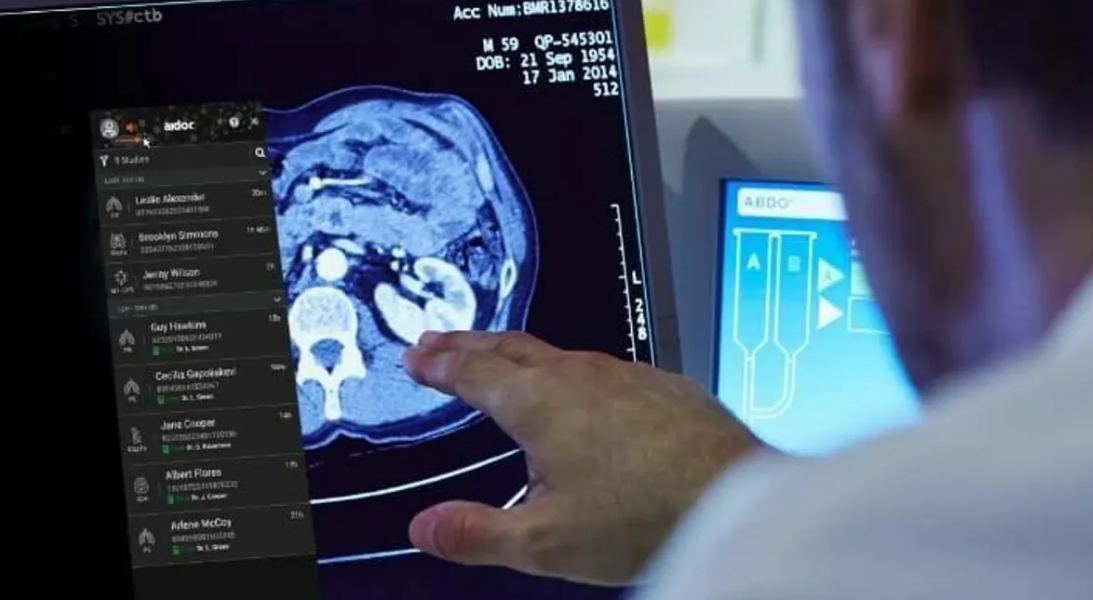How three companies are using foundation models in radiology