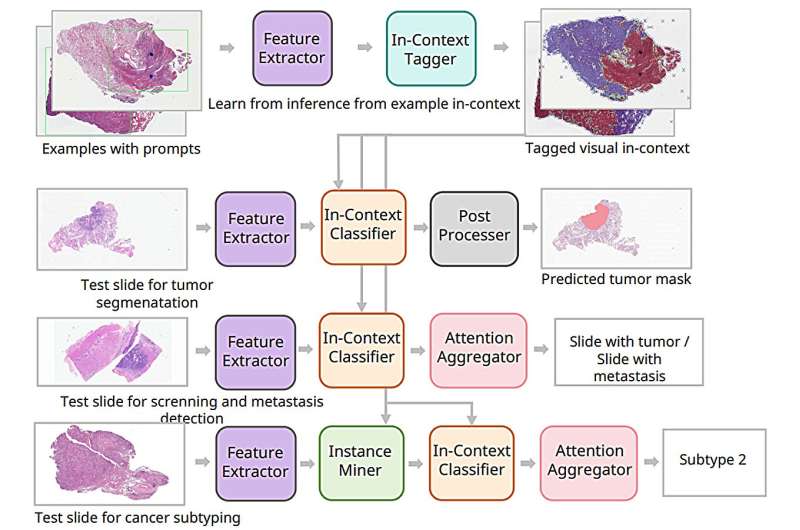 Plug-and-play AI recognizes 18 cancer types from just a handful of slides